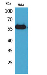 Amylase rabbit pAb