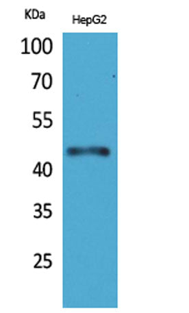 HoxD3 rabbit pAb 50µL/100µL