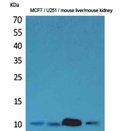 ACBP rabbit pAb
