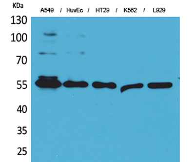 Fascin 1 rabbit pAb