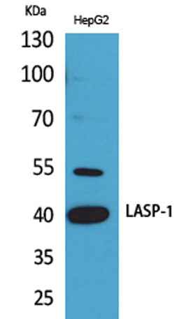 LASP-1 rabbit pAb