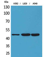 CD158z rabbit pAb
