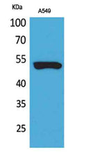 Cytokeratin 8 rabbit pAb