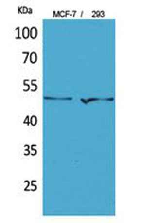 PD-ECGF rabbit pAb