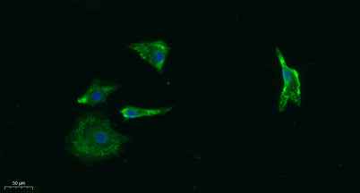 AChRα1 rabbit pAb