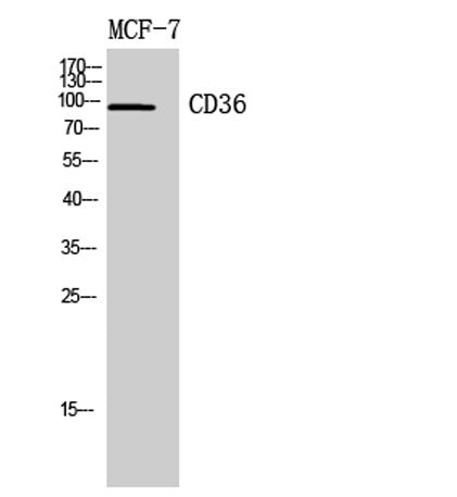 CD36 rabbit pAb 50µL/100µL