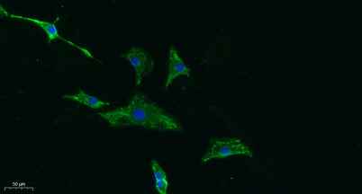CD155 rabbit pAb