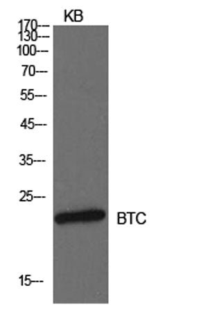 Probetacellulin rabbit pAb 50µL/100µL