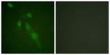 Acetyl Lys proteins rabbit pAb 50µL/100µL