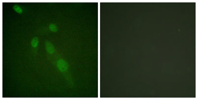 Acetyl Lys proteins rabbit pAb 50µL/100µL