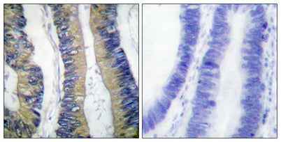 4E-BP1 (phospho Thr69) rabbit pAb