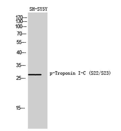 Troponin I-C (phospho Ser22/S23) rabbit pAb