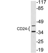 CD24 rabbit pAb 50µL/100µL