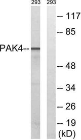 PAK4/5/6 rabbit pAb