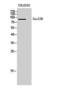 Sec23B rabbit pAb 50µL/100µL