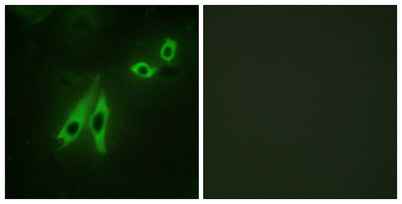 AKAP 110 rabbit pAb
