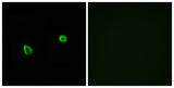 IREβ rabbit pAb 50µL/100µL