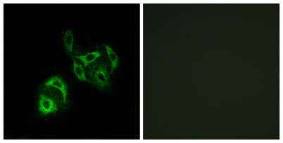 ACSVL4 rabbit pAb