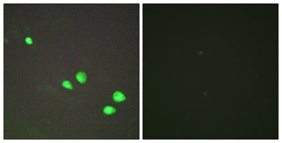 Mi2-β rabbit pAb 50µL/100µL
