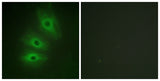 A Cyclase V/VI rabbit pAb 50µL/100µL
