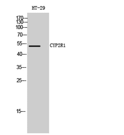 CYP2R1 rabbit pAb 50µL/100µL