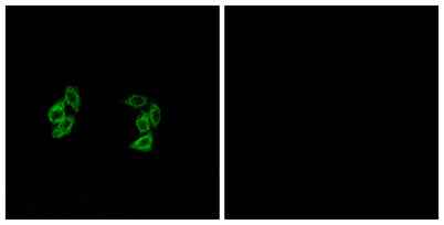 Casein Kinase I α1/1L rabbit pAb