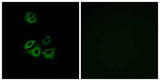 Chemokine Receptor D6 rabbit pAb