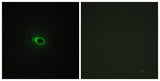 COL12A1 rabbit pAb 50µL/100µL