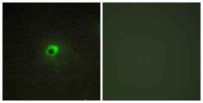 ACTR-IC rabbit pAb