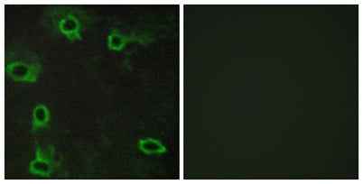 Adenosine A2A-R rabbit pAb