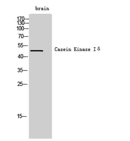 Casein Kinase Iδ rabbit pAb