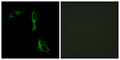 AR-α1D rabbit pAb 50µL/100µL