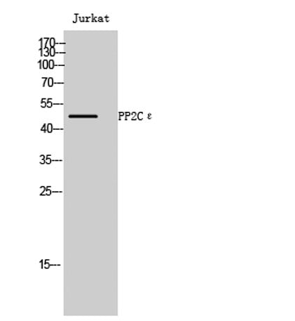 PP2Cε rabbit pAb 50µL/100µL