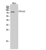 CYP21A2 rabbit pAb 50µL/100µL