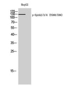 EphA2/3/4 (phospho Tyr588/596) rabbit pAb