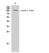 EphA2/5 (phospho Tyr594) rabbit pAb