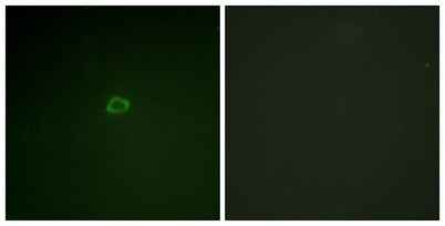 4E-BP1 rabbit pAb