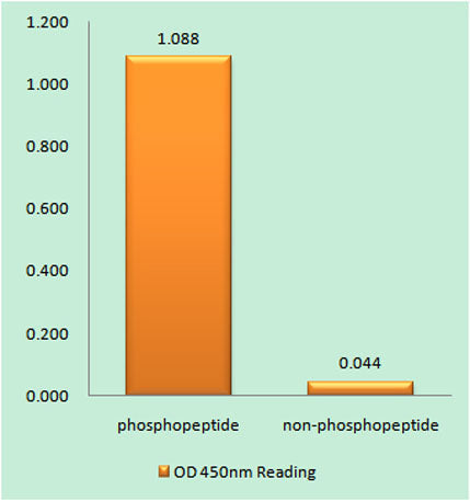 PIP5KIII (phospho Ser307) rabbit pAb 50µL/100µL