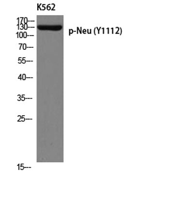 Neu (phospho Tyr1112) rabbit pAb 50µL/100µL