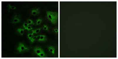 ErbB-4 (phospho Tyr1284) rabbit pAb