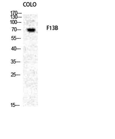 Factor XIII B rabbit pAb