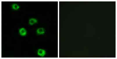 Latrophilin-2 rabbit pAb