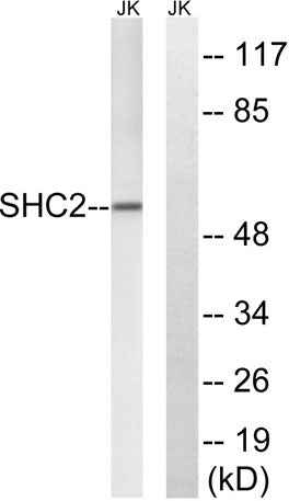 Sck rabbit pAb