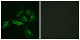 GnRH-R rabbit pAb