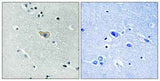 NMDAζ1 (phospho Ser890) rabbit pAb