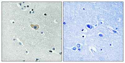 NMDAζ1 (phospho Ser890) rabbit pAb
