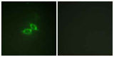 NMDAζ1 rabbit pAb