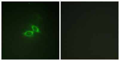 NMDAζ1 rabbit pAb