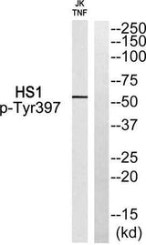 Lck BP-1 (phospho Tyr397) rabbit pAb