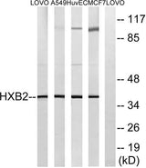 HoxB2 rabbit pAb